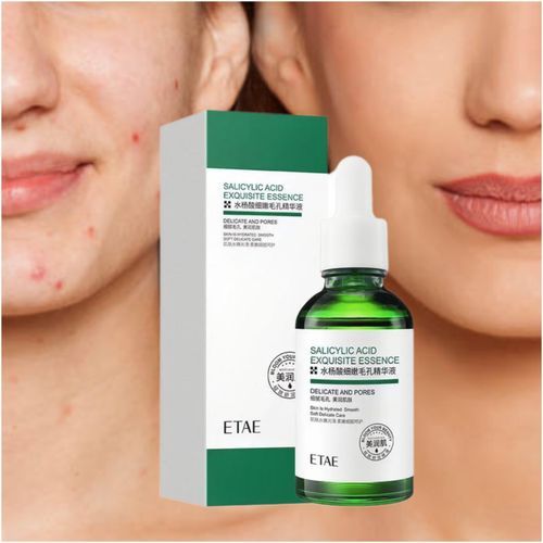 Acne Face Serum