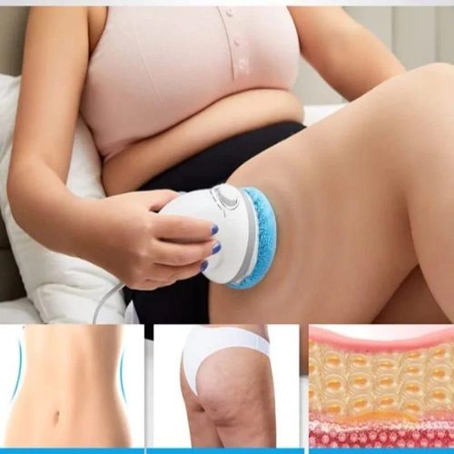 Cellulite Massager, Body Sculpting Machine, Handheld Electric Body Massager Skin Tightening for Belly Waist Butt Arms Legs Suggest a change -Multicolor