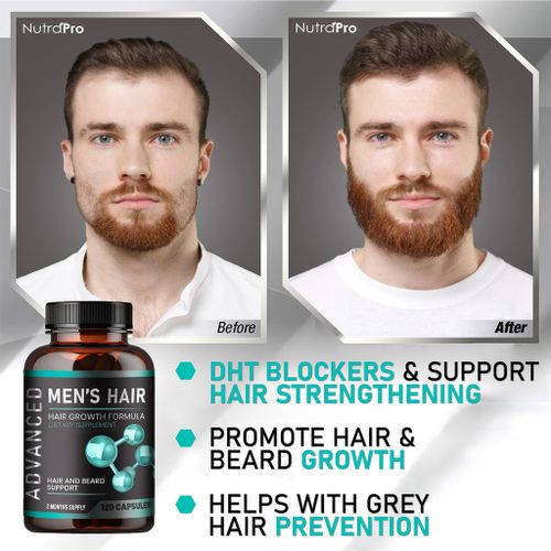 Kirkland Minoxidil Grey Hair Treatment Capsules - 120caps