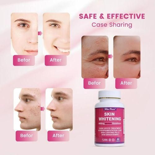 Wins Town Skin Whitening Tablet - 8000mg