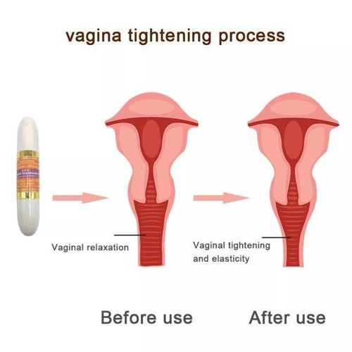 Tightening stick