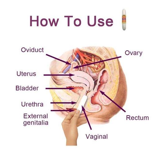Tightening stick