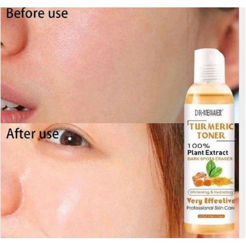 Dr.Meinaier Tumeric Toner 100% Plant Extract Dark Spots Eraser
