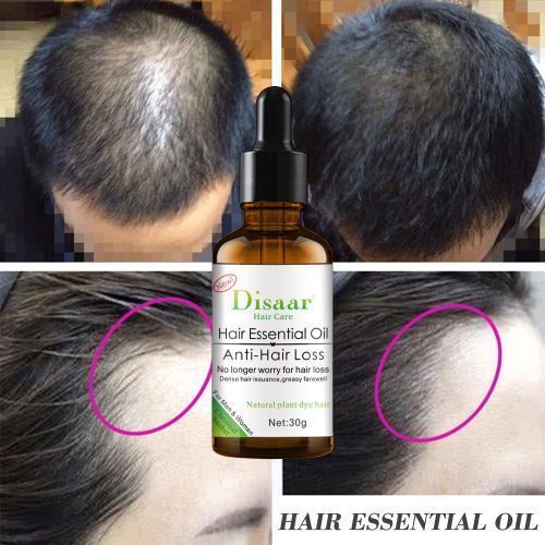Disaar Hair Care Essential Oil For Anti Hair Loss 30g