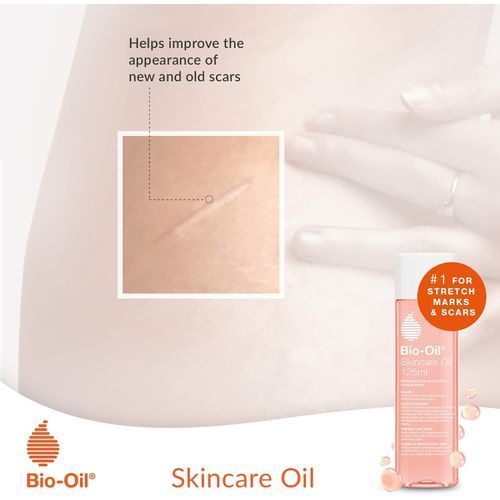 Bio Oil Skincare Oil - Improves Appearance Of Scars, Stretch Marks & Skin Tone – 60ml (UK Origin)