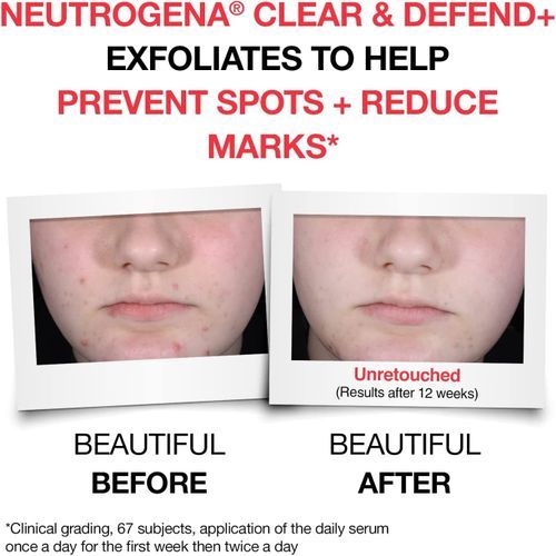Neutrogena Clear And Defend+ Serum 30ml