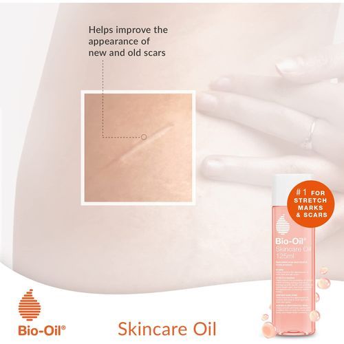Bio Oil Skincare Oil - Improves Appearance Of Scars, Stretch Marks And Skin Tone, 200ml (UK Origin)