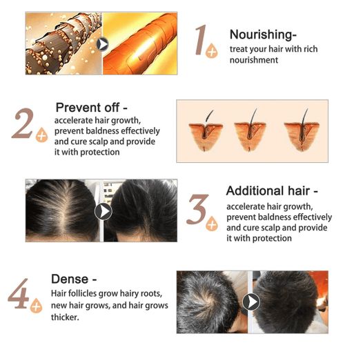 Mielle Organics Rosemary Scalp & Hair Strengthening Oil For All Hair Types