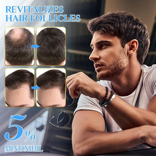 Kirkland Minoxidil 5% Hair Growth Oil Spray For Men, Nourishes The Scalp, Reduce Thinning & Hair Loss & Derma Roller