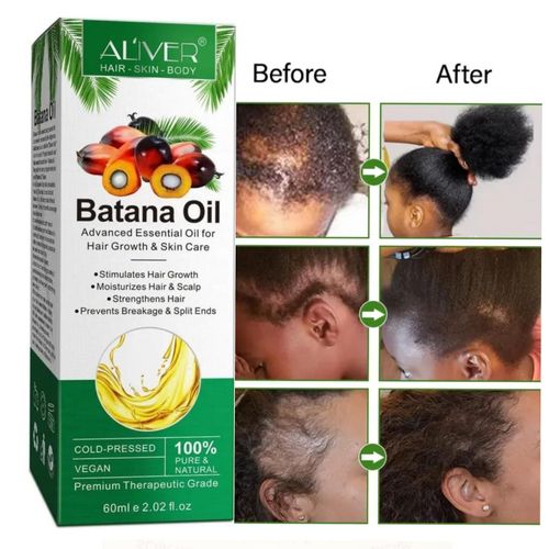 Aliver Batana Hair Growth Oil - 60mls