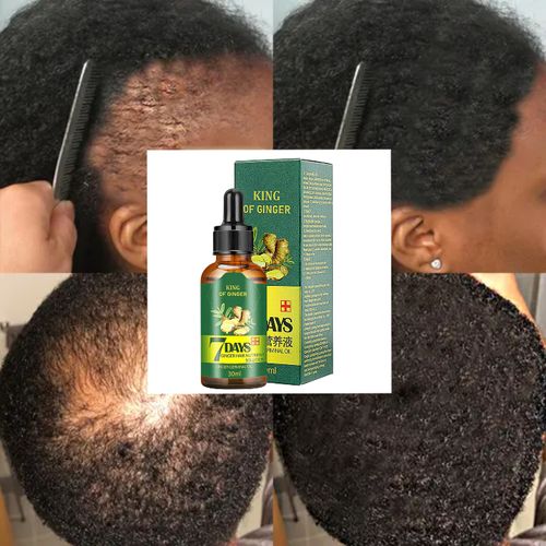 7 Day Ginger Hair Growth Oil  - 30ml