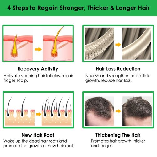 7 Day Ginger Hair Growth Oil  - 30ml
