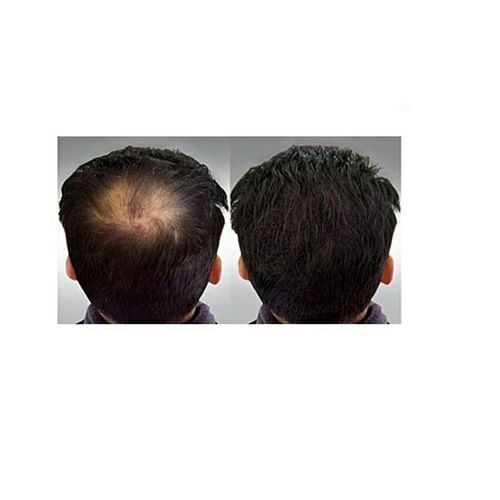 Disaar Hair Care Essential  Oil Anti Hair Loss 30g