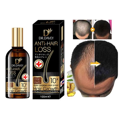 Dr Davey Hair Growth Spray Anti-Hair Loss, Hair Growth 100ml