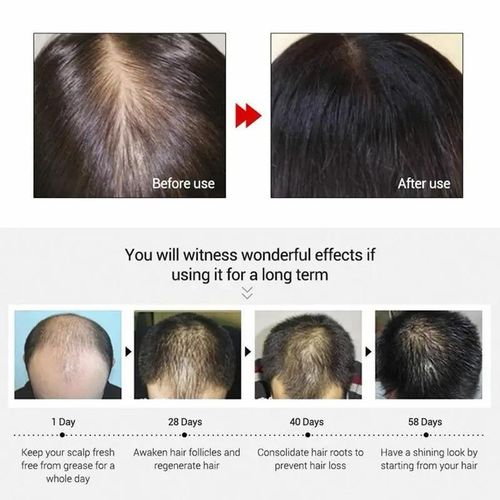 Andrea Hair And Beard Growth Oil - 20ml