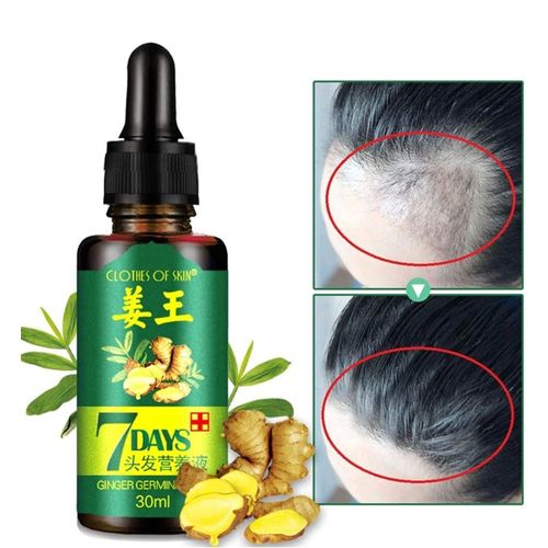 7 Day 7 Days Ginger Hair Growth Oil  - 30ml