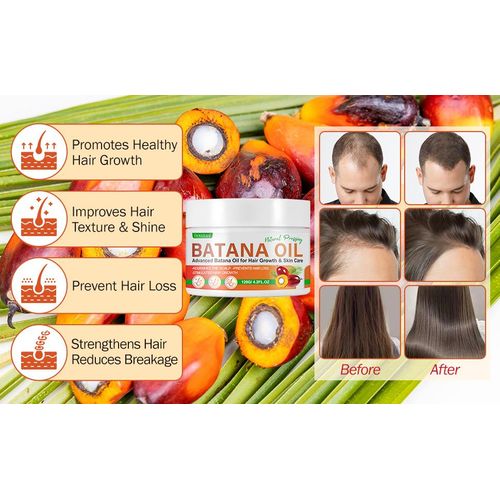 Mielle 100% Batana Oil From Honduras As Hair Mask, Scalp & Hair Oil,Repairs Damaged Hair & Skin, Reduces Hair Loss - 120g