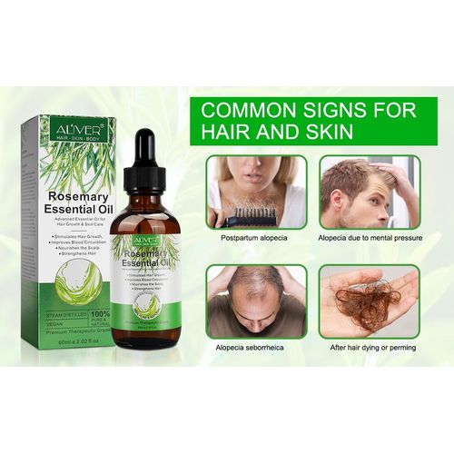 Mielle Natural Rosemary Oil for Hair Loss Treatment, Stimulates Hair Growth, Scalp Massager, Aromatherapy