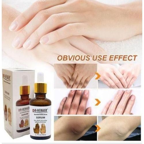 Dr.Meinaier Strong Dark Knuckles Removal Serum - 50ml
