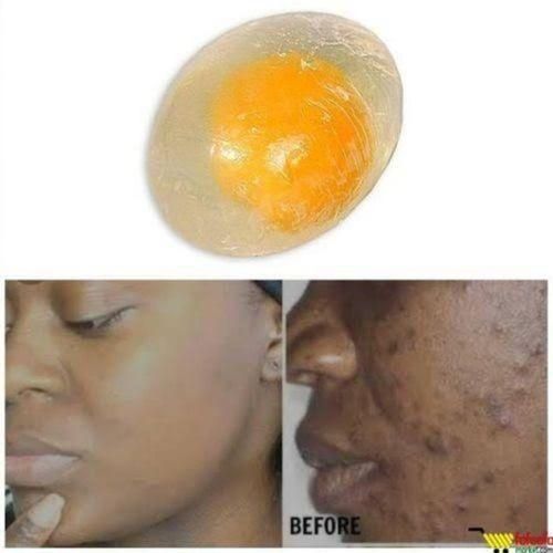 Egg Soap Egg Yolk Collagen Facial Soap For Sun Burn, Acne, Dark Spots