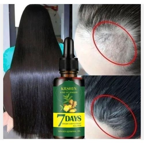 Lanbena 7 Days Ginger Hair Growth Oil - 30ml