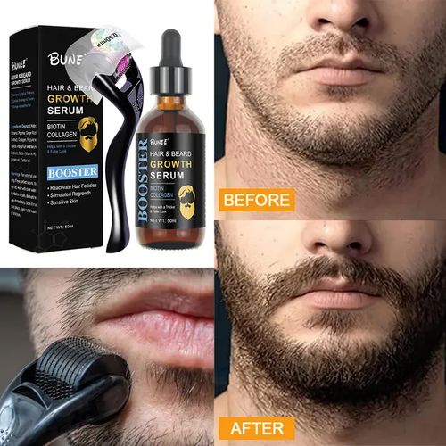 Kirkland Minoxidil Hair And Beard Growth kit
