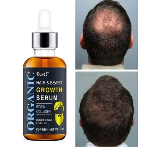 Kirkland Bunee Hair & Beard Growth 50mls
