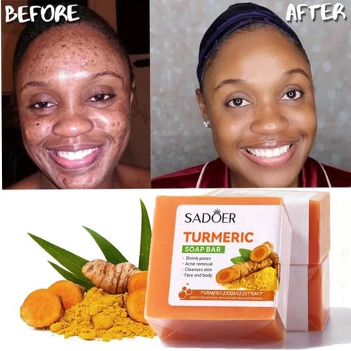 Tumeric Dark Spot & Brightening Glow Bar Soap, For Face and Body - 100g