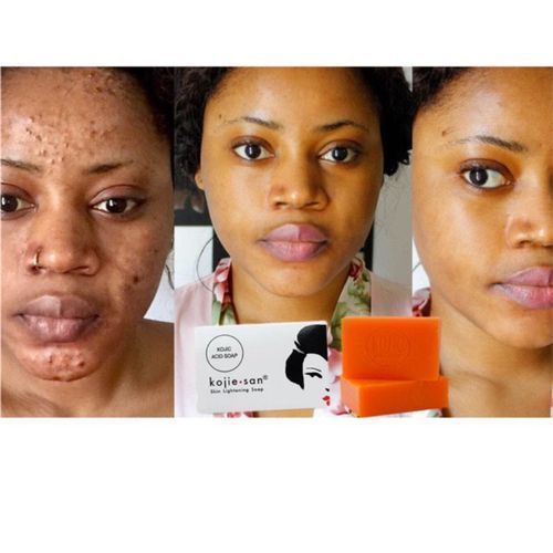 Kojie San Skin Lightening Kojic Acid Soap -135g