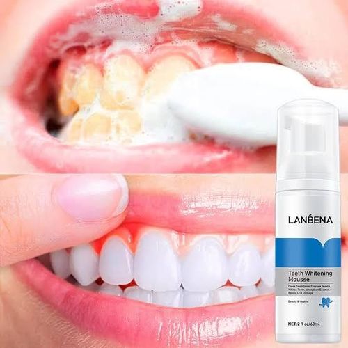 The Authentic LANBENA, Teeth Whitening Mousse 60ml