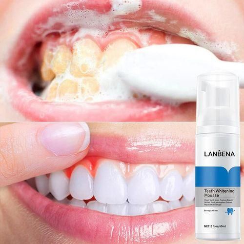Lanbena Teeth Whitening Foam Mousse Whitening Teeth Stain Tooth & - Clean Freshen Breath, Whiten Teeth