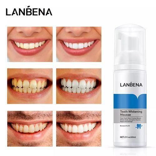 Lanbena Afforddable Teeth Whitening Mousse Tooth Cleaning Remove Quick Repair Of Cavities Caries Filling Removal Of Stains Plaque Decay Yellowing White Teeth Oral Hygiene Toothpaste Bleaching Whitening Dental Tool Real Teeth Whitener - White 2fl Oz /60ml