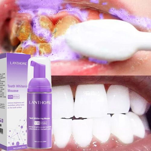 Lanthome 50ml Teeth Cleaning Whitening Mousse Deep Cigarette Stains Repair Bright Neutralizes Yellow Tones Plaques Fresh Breath