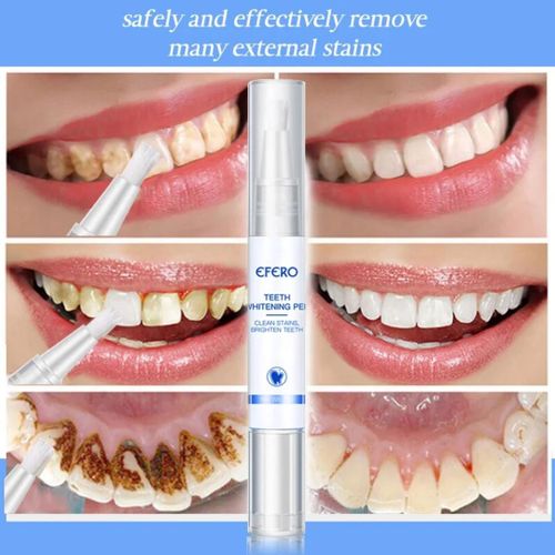 Efero Teeth Whitening Pen Teeth Whitening Pen Fast Cleaning Remove Plaque Stains Oral Hygiene White Teeth Tool