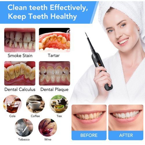 2 In 1 Electric Toothbrush, Sonic Dental Scaler, Waterproof Dental Scaling Kit