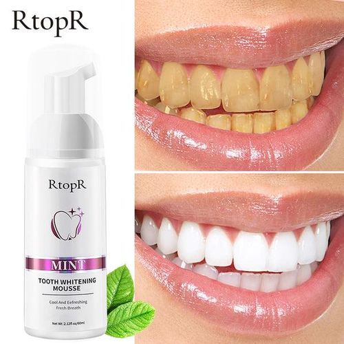 RtopR Teeth Whitening Mousse