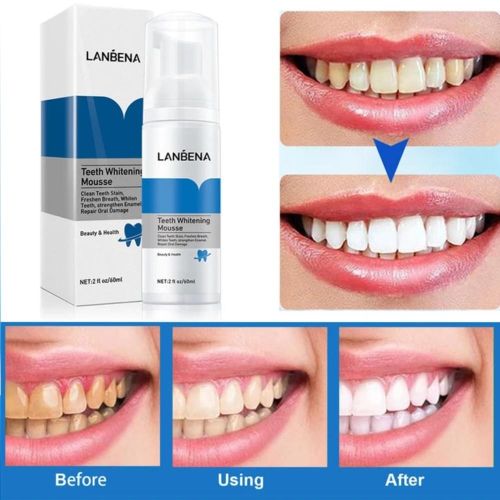 Lanbena Teeth Whitening Mousse Remove Tooth Stains - 60mls