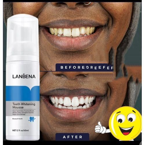 Lanbena Teeth Whitening Mousse - 60mls