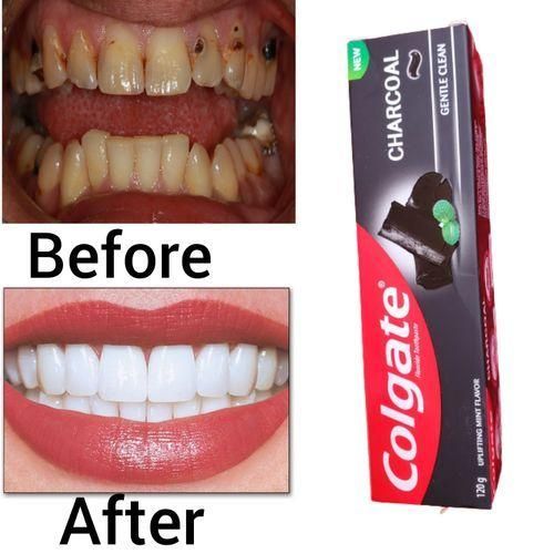 Colgate  Original Charcoal Teeth Whitening Tooth paste - 120g