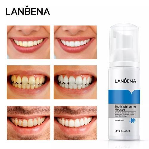 Lanbena Afforddable Teeth Whitening Mousse Tooth Cleaning Remove Quick Repair Of Cavities Caries Filling Removal Of Stains Plaque Decay Yellowing  White Teeth Oral Hygiene Toothpaste Bleaching Whitening Dental Tool Real Teeth Whitener - White 2fl Oz /60ml