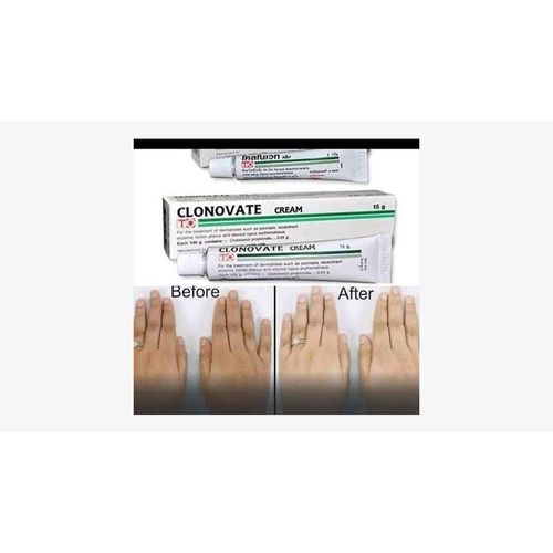 Clonovate Skin Lightening Cream-15g Very Effective