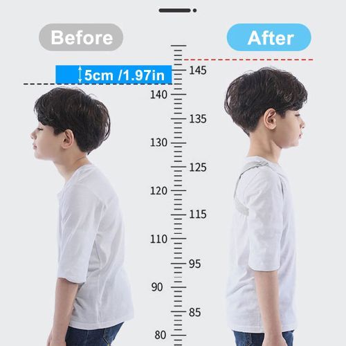 Smart Auto Adjustable Intelligent Posture Trainer - Upper Back Brace For Adults & Kids