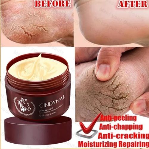 Foot Hand Cream Anti-Aging Moisturizing