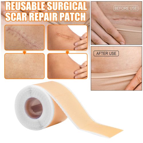 Scars Sheets Treatment Tapes Easy Removal Professional Scar Removal
