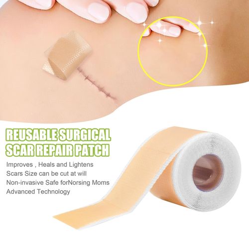 Scars Sheets Treatment Tapes Easy Removal Professional Scar Removal
