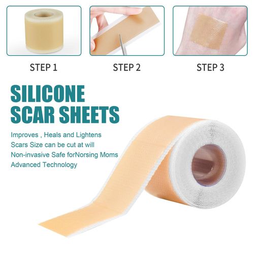 Scars Sheets Treatment Tapes Easy Removal Professional Scar Removal
