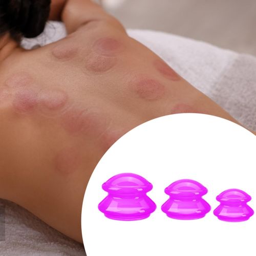 3 Pieces Professional Vacuum Cupping Silicone Cupping Rose