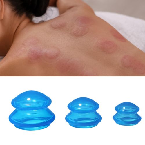 3 Pieces Professional Vacuum Cupping Silicone Cupping Blue