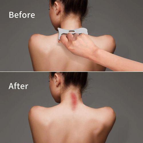 Stainless Steel Gua Sha Professional Multi Functional