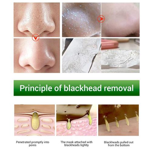 Pore Nose Strips,  For Woman, 160